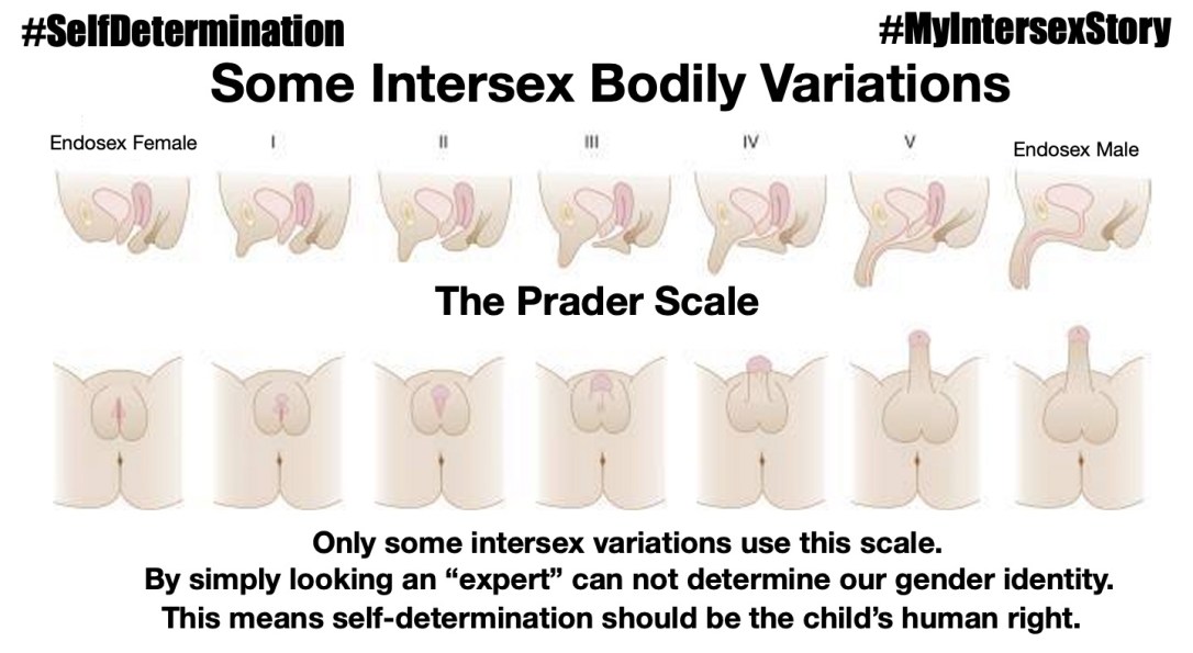 The Prader Scale Some Intersex Bodily Variations